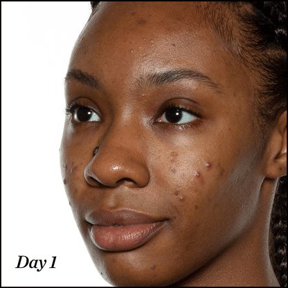 Patch’Glow — Pimple Patches (Étoiles & Classiques)