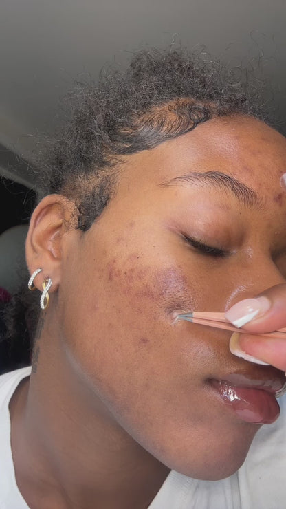 Patch’Glow — Pimple Patches (Étoiles & Classiques)